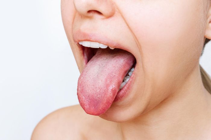 Indikator für Dehydration trockener Mund