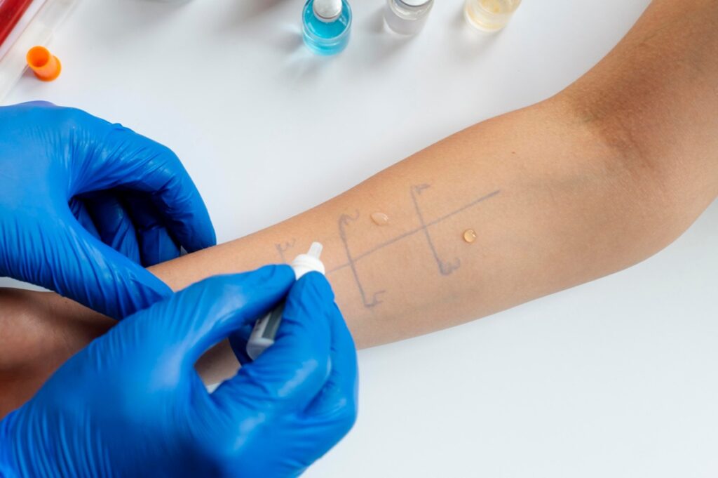 Allergien Test
