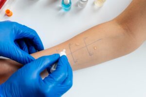 Allergien Test